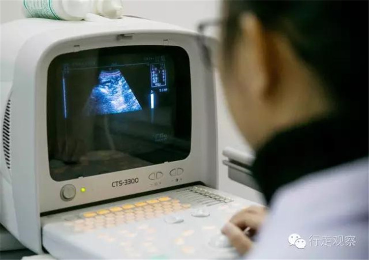 体外碎石